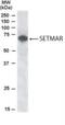 SET Domain And Mariner Transposase Fusion Gene antibody, NB100-1142, Novus Biologicals, Western Blot image 
