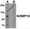 Zinc Finger MIZ-Type Containing 1 antibody, 6237, ProSci, Western Blot image 