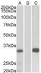 Aminoacyl TRNA Synthetase Complex Interacting Multifunctional Protein 1 antibody, 43-037, ProSci, Western Blot image 