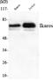 IKAROS Family Zinc Finger 1 antibody, STJ98508, St John
