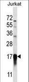 Prefoldin Subunit 5 antibody, LS-C163535, Lifespan Biosciences, Western Blot image 