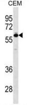 T-Box 5 antibody, AP54186PU-N, Origene, Western Blot image 