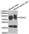 Potassium Voltage-Gated Channel Subfamily A Member 2 antibody, PA5-76901, Invitrogen Antibodies, Western Blot image 