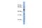 RAB3A Interacting Protein antibody, NBP1-56745, Novus Biologicals, Western Blot image 