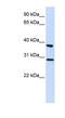 Inhibitor Of Growth Family Member 4 antibody, NBP1-79383, Novus Biologicals, Western Blot image 