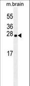 Latexin antibody, LS-C163927, Lifespan Biosciences, Western Blot image 