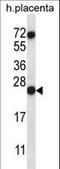 Ribonuclease A Family Member 8 antibody, LS-C162639, Lifespan Biosciences, Western Blot image 