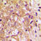 TIMP Metallopeptidase Inhibitor 2 antibody, LS-C352955, Lifespan Biosciences, Immunohistochemistry frozen image 