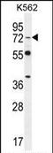 Dishevelled Segment Polarity Protein 3 antibody, PA5-35096, Invitrogen Antibodies, Western Blot image 