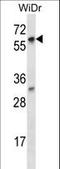 La Ribonucleoprotein Domain Family Member 7 antibody, LS-C165688, Lifespan Biosciences, Western Blot image 
