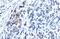Glypican 3 antibody, GTX130732, GeneTex, Immunohistochemistry paraffin image 