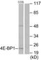 Eukaryotic Translation Initiation Factor 4E Binding Protein 1 antibody, LS-B12518, Lifespan Biosciences, Western Blot image 