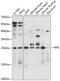 Ribulose-5-Phosphate-3-Epimerase antibody, 15-724, ProSci, Western Blot image 