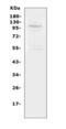 Transient Receptor Potential Cation Channel Subfamily C Member 6 antibody, LS-C312900, Lifespan Biosciences, Western Blot image 