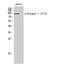 Dynamin 1 antibody, STJ90787, St John