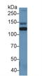 Inter-Alpha-Trypsin Inhibitor Heavy Chain 4 antibody, LS-C294707, Lifespan Biosciences, Western Blot image 