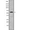 ER Degradation Enhancing Alpha-Mannosidase Like Protein 2 antibody, abx215067, Abbexa, Western Blot image 
