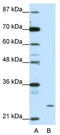 Zinc Finger Protein 253 antibody, TA345320, Origene, Western Blot image 