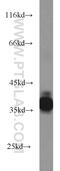 Peripherin-2 antibody, 18109-1-AP, Proteintech Group, Western Blot image 