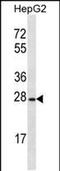 Olfactory Receptor Family 8 Subfamily B Member 12 antibody, PA5-48712, Invitrogen Antibodies, Western Blot image 