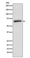 Ubiquitin Specific Peptidase 22 antibody, M03887, Boster Biological Technology, Western Blot image 