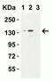 Lysine Demethylase 6B antibody, NBP2-82107, Novus Biologicals, Western Blot image 