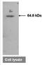 5-Aminoimidazole-4-Carboxamide Ribonucleotide Formyltransferase/IMP Cyclohydrolase antibody, orb109164, Biorbyt, Western Blot image 