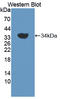 Receptor Like Tyrosine Kinase antibody, LS-C375005, Lifespan Biosciences, Western Blot image 