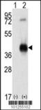 Calcium/Calmodulin Dependent Protein Kinase I antibody, 62-731, ProSci, Western Blot image 