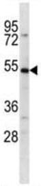 Solute Carrier Family 39 Member 14 antibody, ab123988, Abcam, Western Blot image 