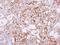 Semaphorin-6A antibody, NBP1-31551, Novus Biologicals, Immunohistochemistry frozen image 