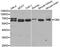 Cystathionine-Beta-Synthase antibody, MBS127233, MyBioSource, Western Blot image 