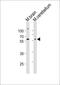 Terminal Nucleotidyltransferase 2 antibody, A32403, Boster Biological Technology, Western Blot image 