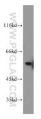 Kruppel Like Factor 10 antibody, 11881-1-AP, Proteintech Group, Western Blot image 