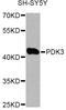 Pyruvate Dehydrogenase Kinase 3 antibody, A12480, ABclonal Technology, Western Blot image 