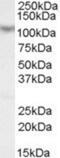 Mastermind Like Transcriptional Coactivator 1 antibody, NB100-1306, Novus Biologicals, Western Blot image 