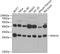 N(Alpha)-Acetyltransferase 10, NatA Catalytic Subunit antibody, GTX64704, GeneTex, Western Blot image 
