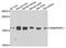 Cbl Proto-Oncogene C antibody, A03693-1, Boster Biological Technology, Western Blot image 