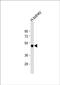 Potassium Voltage-Gated Channel Subfamily J Member 15 antibody, PA5-48818, Invitrogen Antibodies, Western Blot image 