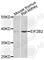 Eukaryotic Translation Initiation Factor 2B Subunit Beta antibody, A7027, ABclonal Technology, Western Blot image 