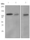 Fibrinogen Alpha Chain antibody, ab92572, Abcam, Western Blot image 