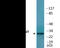 Snail Family Transcriptional Repressor 1 antibody, EKC2339, Boster Biological Technology, Western Blot image 