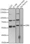 Ceramide kinase antibody, 16-303, ProSci, Western Blot image 