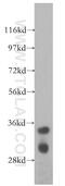 DIMT1 RRNA Methyltransferase And Ribosome Maturation Factor antibody, 15563-1-AP, Proteintech Group, Western Blot image 