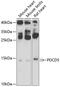 Programmed cell death protein 5 antibody, 22-844, ProSci, Western Blot image 