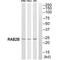 RAB2B, Member RAS Oncogene Family antibody, A12256, Boster Biological Technology, Western Blot image 