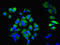 Keratin 6A antibody, LS-C369891, Lifespan Biosciences, Immunofluorescence image 