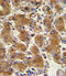 Collagen Type VI Alpha 1 Chain antibody, A02226-4, Boster Biological Technology, Immunohistochemistry paraffin image 