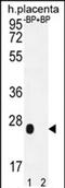 Olfactory Receptor Family 2 Subfamily J Member 3 antibody, PA5-71619, Invitrogen Antibodies, Western Blot image 