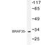 MAX Dimerization Protein MLX antibody, LS-C176839, Lifespan Biosciences, Western Blot image 